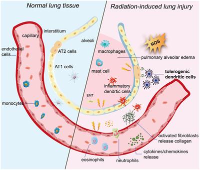 Tolerogenic dendritic cells in radiation-induced lung injury